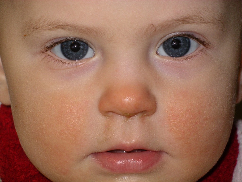 IMGP8646.JPG - Agnes förkyld... vintern 2007.