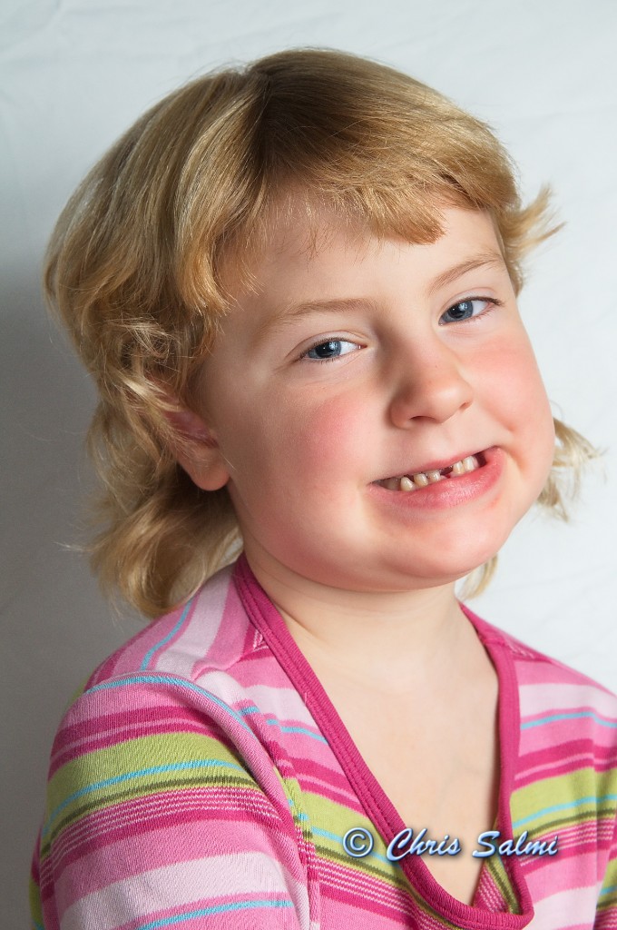 _DSC8805.JPG - Viktigt att det syns på bilden att tanden är borta